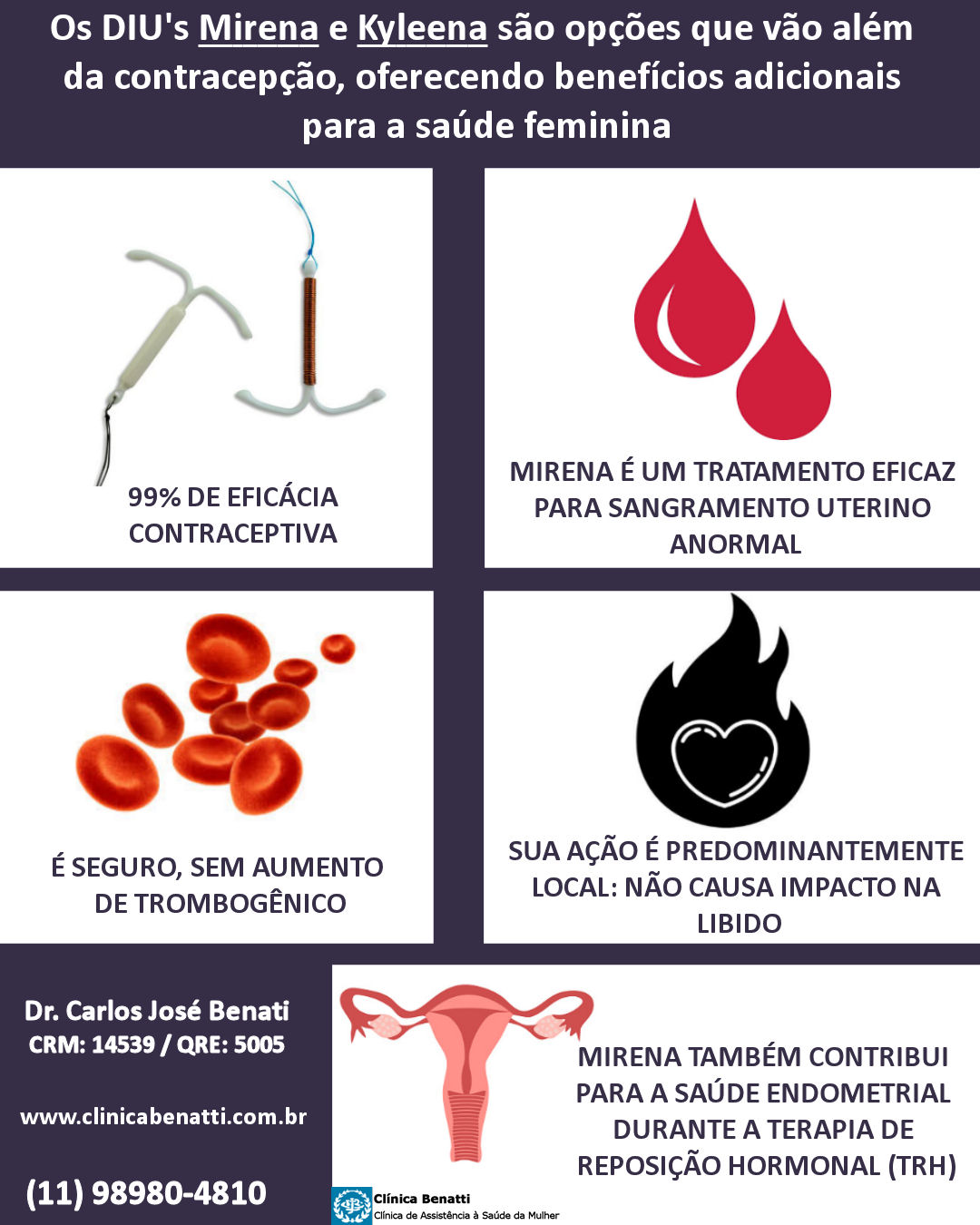 Os DIUs Mirena e Kyleena: Mais do que contracepção, um cuidado com a saúde feminina