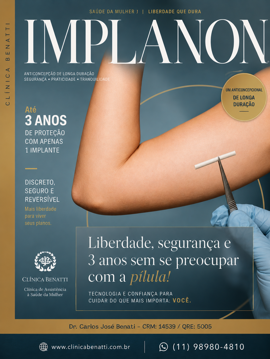 Implanon: o anticoncepcional que você não precisa lembrar todos os dias!