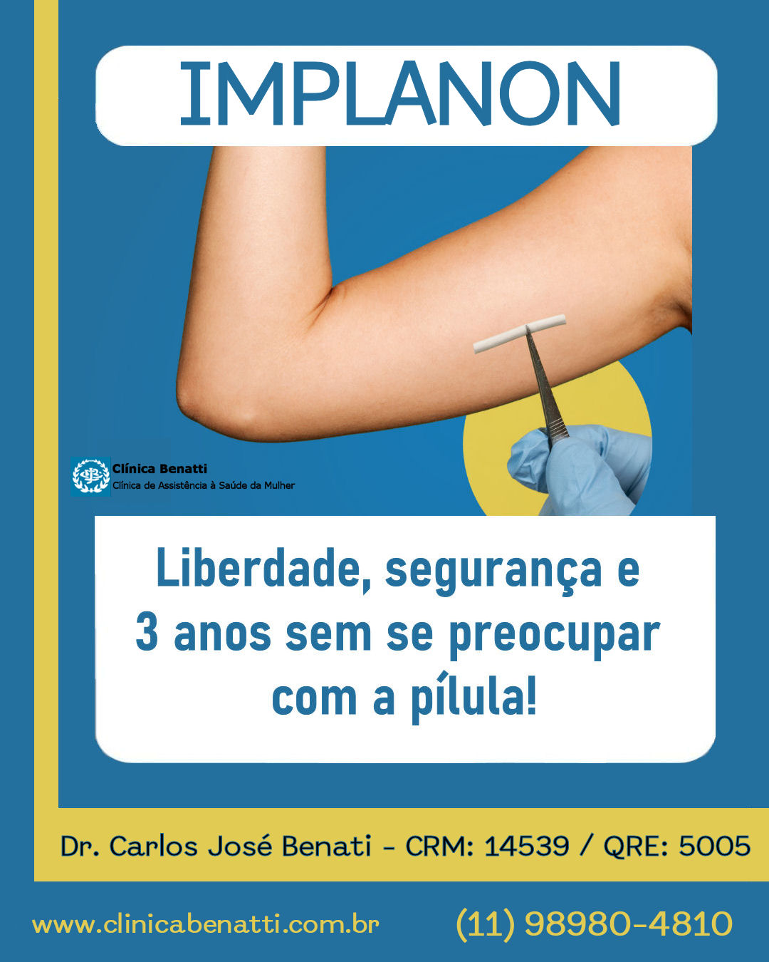 Implanon: o anticoncepcional que você não precisa lembrar todos os dias!
