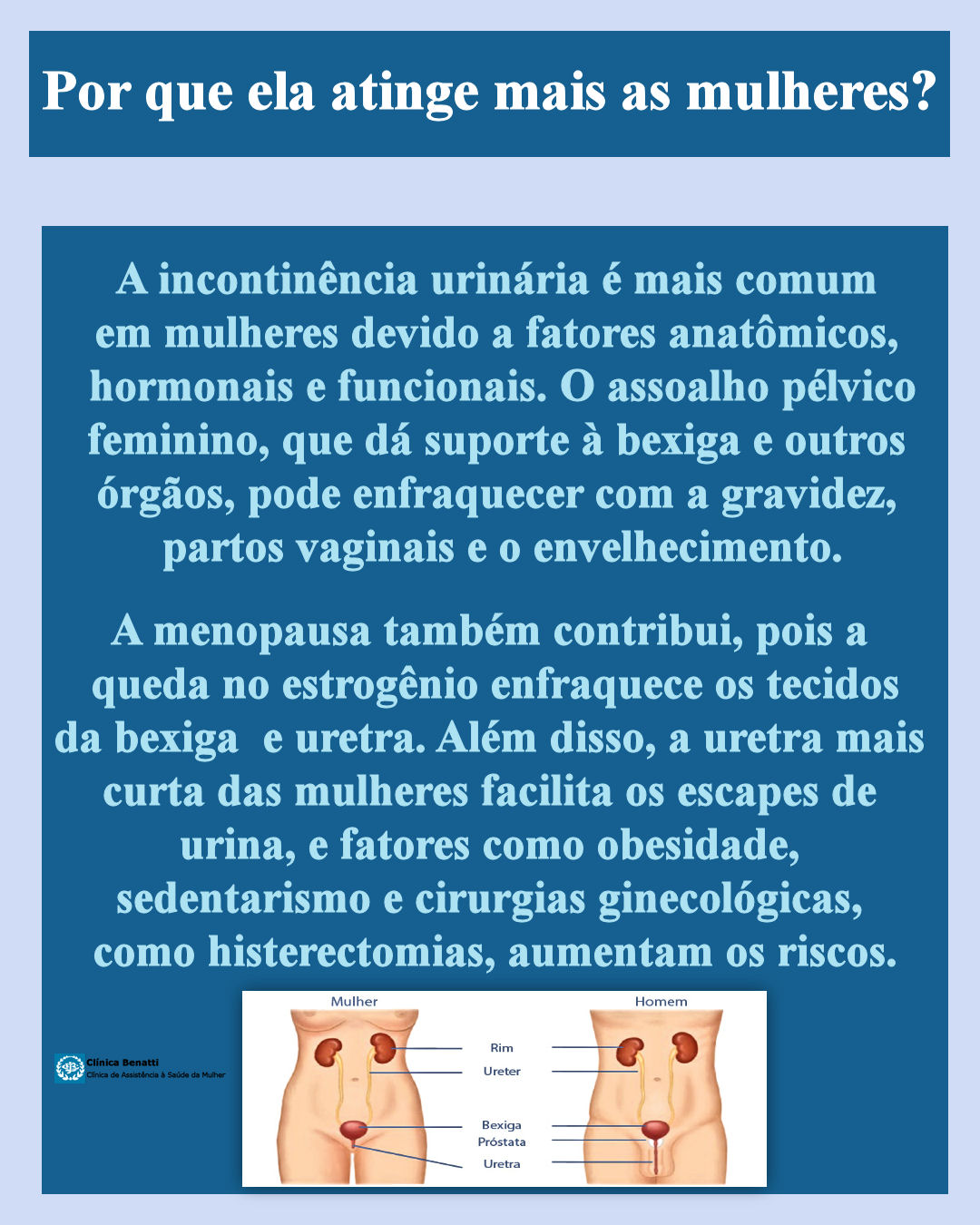 Tudo o que você precisa saber sobre Incontinência Urinária