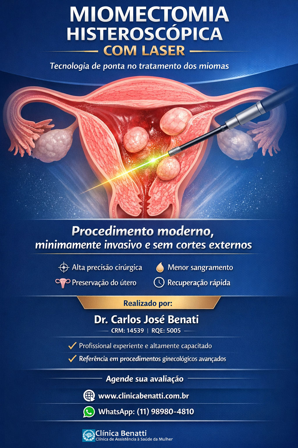 Miomectomia Histeroscópica com Laser | Tecnologia e Precisão na Saúde Feminina