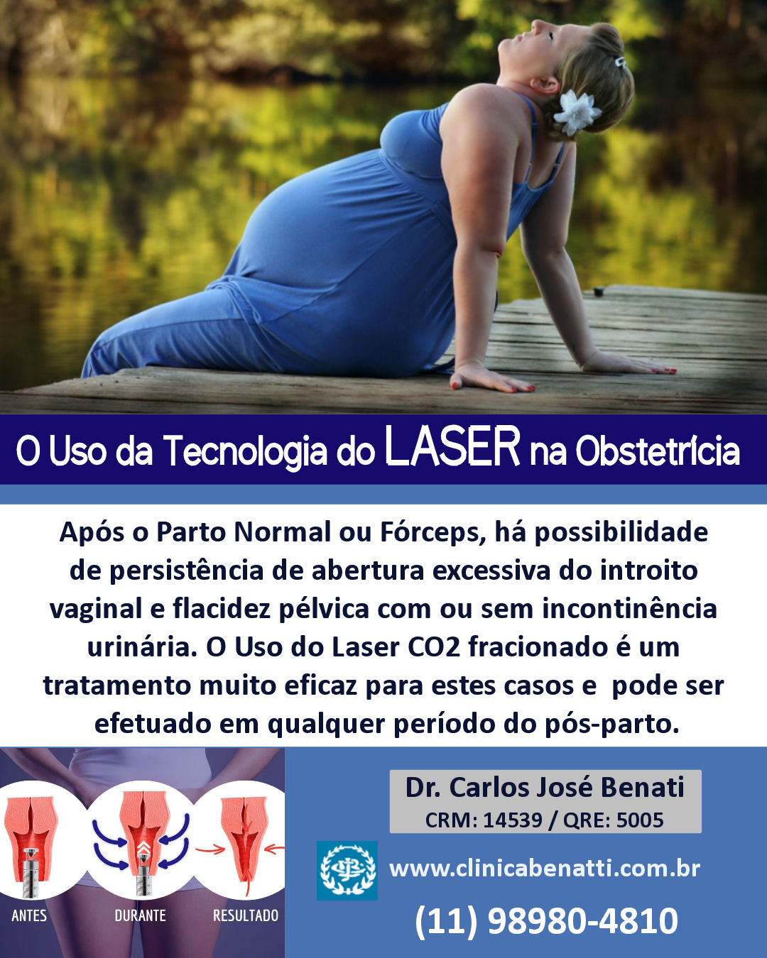 Laser Vaginal no Pós-Parto: Recuperação e Bem-Estar Feminino