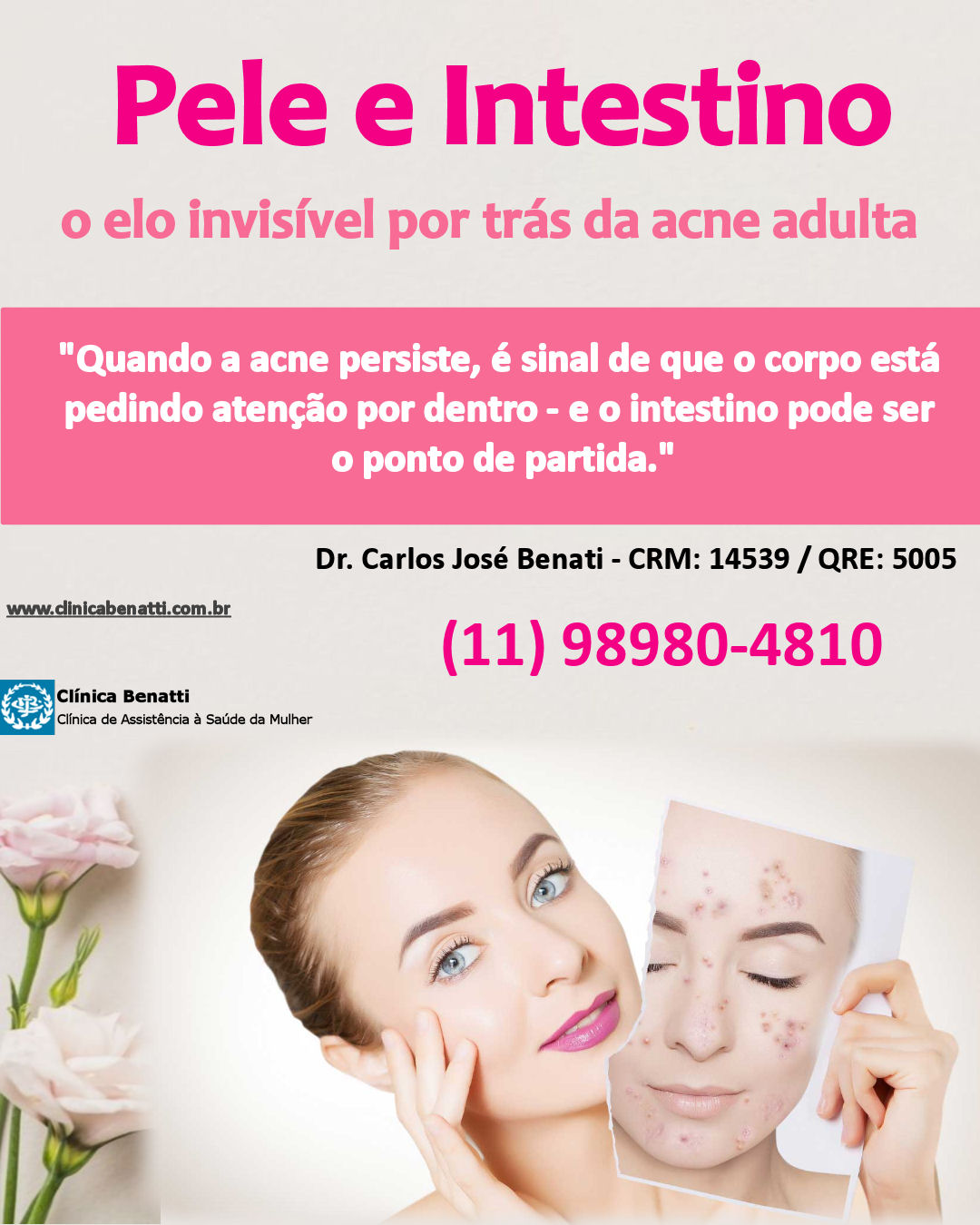 Pele e intestino: o elo invisível por trás da acne adulta